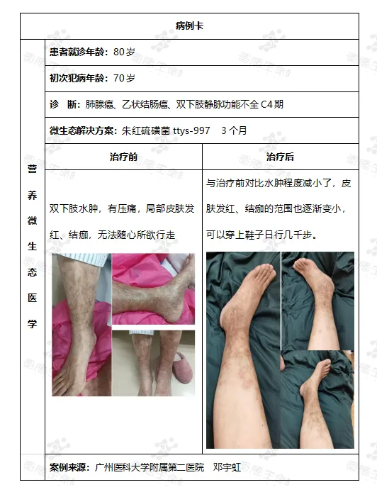 皮肤炎症的微生态解决方案