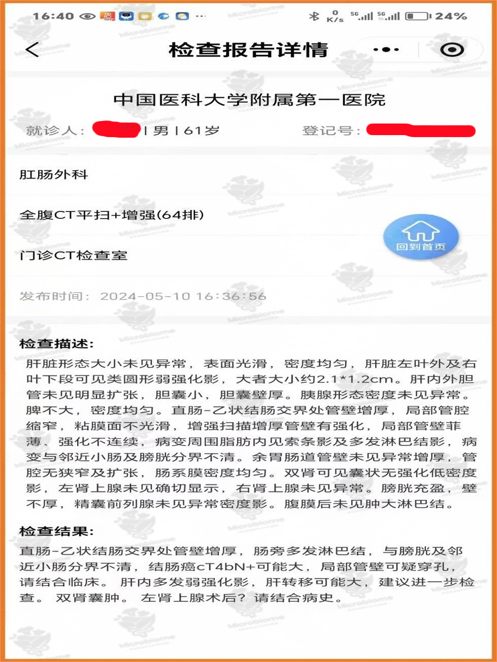 肠癌肝转移、肺转移，营养+化疗4个月，肿瘤缩小，癌标下降，体重再增长8Kg！——营养微生态医学临床案例