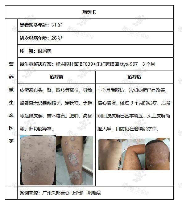 皮肤炎症的微生态解决方案