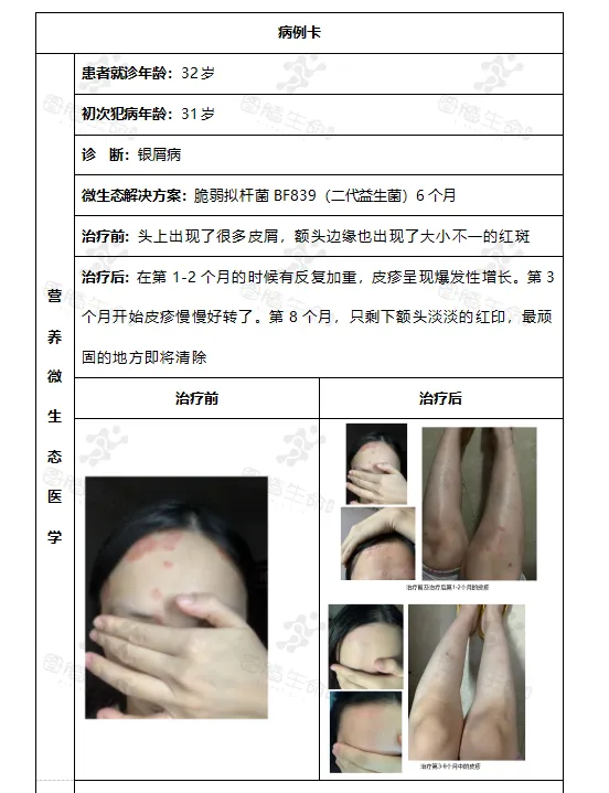 皮肤炎症的微生态解决方案