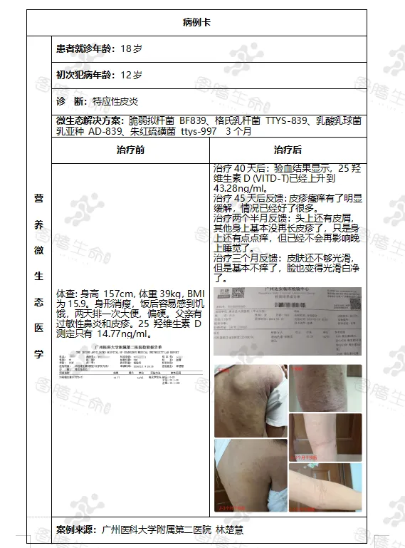 皮肤炎症的微生态解决方案