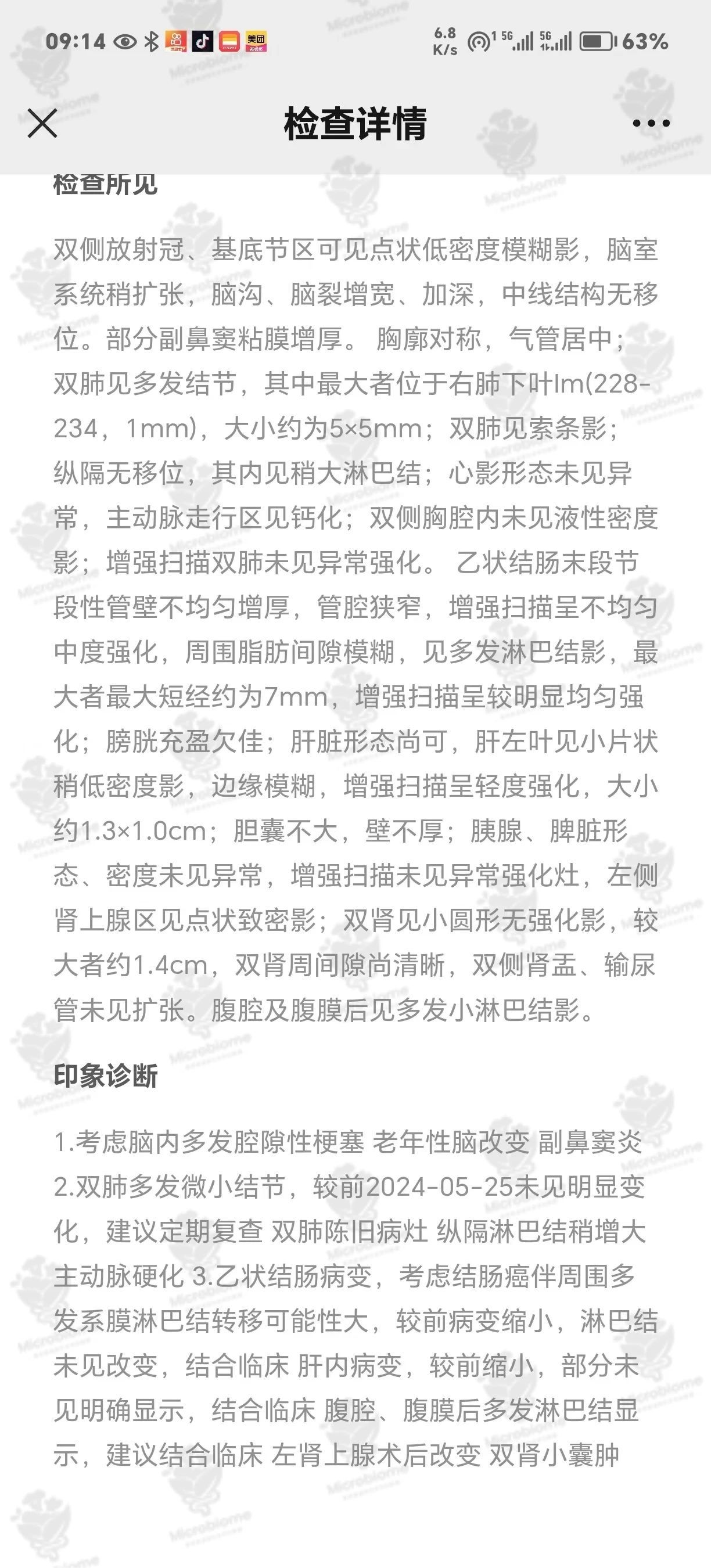 肠癌肝转移、肺转移，营养+化疗4个月，肿瘤缩小，癌标下降，体重再增长8Kg！——营养微生态医学临床案例